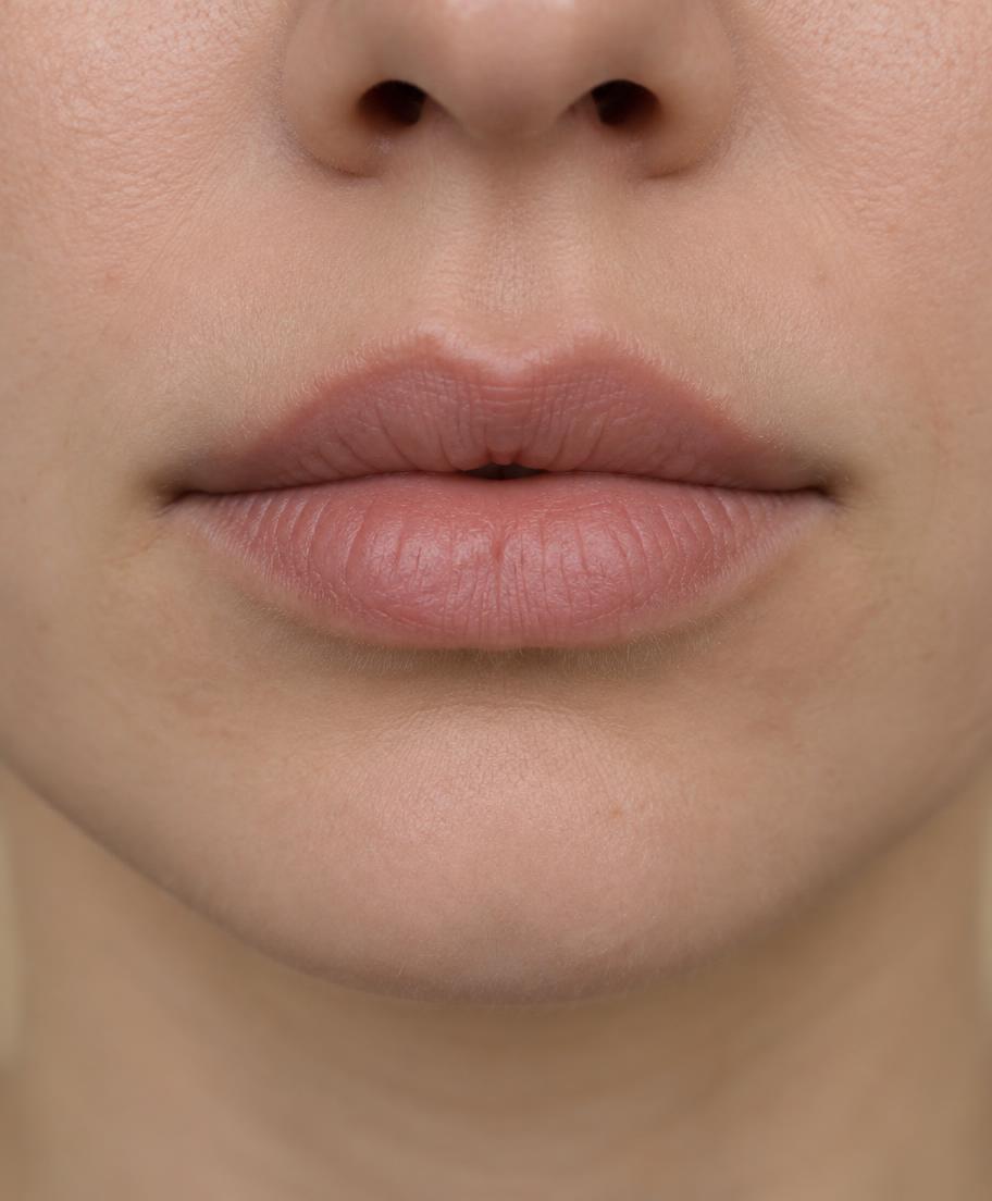 Permanent Make-up: Lippenpigmentierung – Vorher
